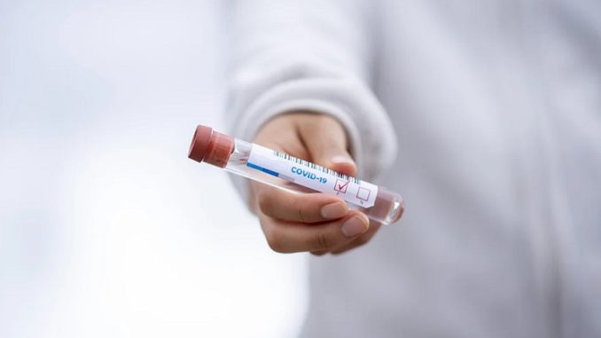 Coronavirus: Abbott vince il bando, dal 4/5 via ai test sierologici