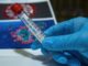 Coronavirus: test immunità, partono le prime chiamate