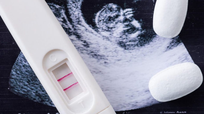 Aborto: Piemonte, dubbi legalità linee guida