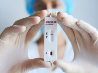 Test antigenici rapidi, forniture assicurate dalla Regione alle aziende sanitarie locali