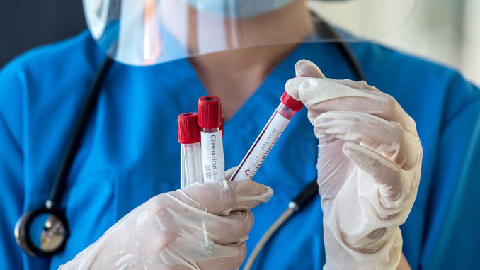 Vaccini, test sierologici per verificarne l’efficacia