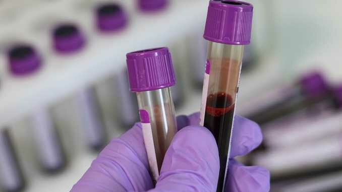 test laboratorio sangue Le iniziative astigiane per la Giornata mondiale contro l’Aids