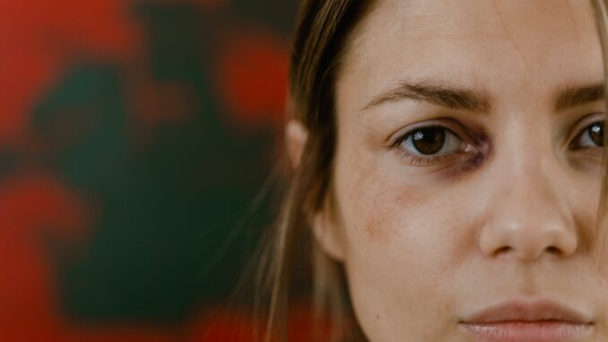 Alessandra, più forte della violenza