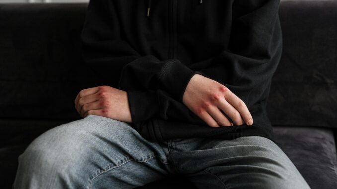 L'appello di una mamma / Sono bestie feroci: picchiano fuori dai locali i nostri ragazzi